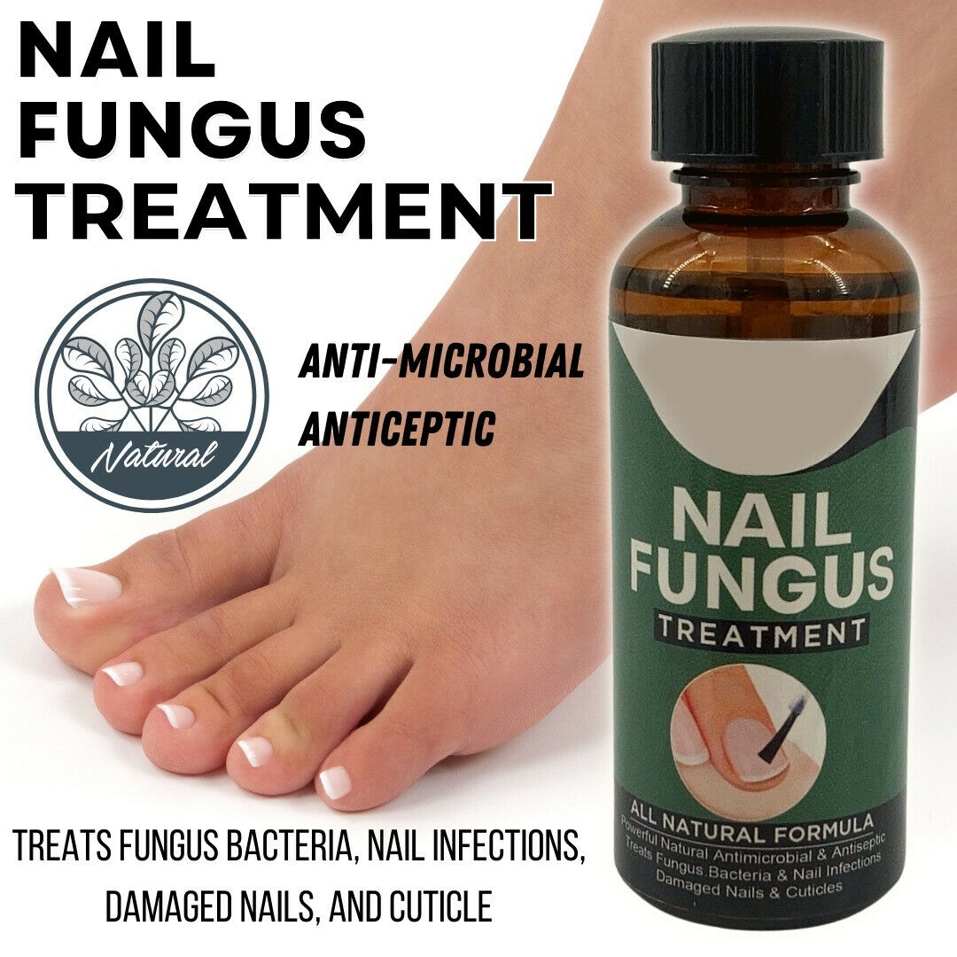TJ Anti Fungal Nail Treatment Nail Finger Toe Fungus Onychomycosis Remover
