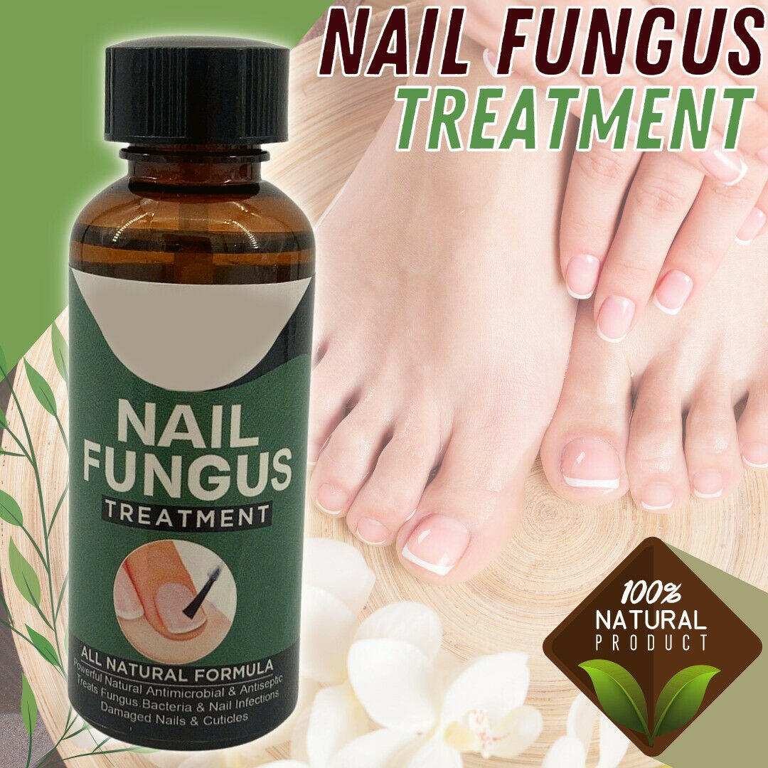 TJ Anti Fungal Nail Treatment Nail Finger Toe Fungus Onychomycosis Remover
